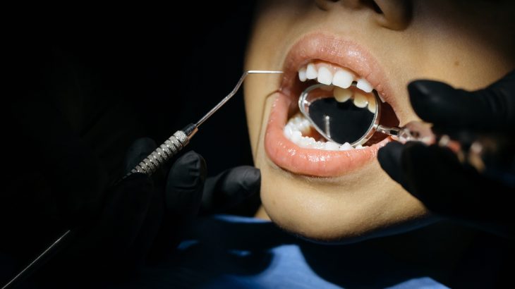 Comment pousse les dents
