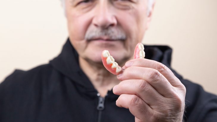prothèse amovible supra implantaire édentement partiel