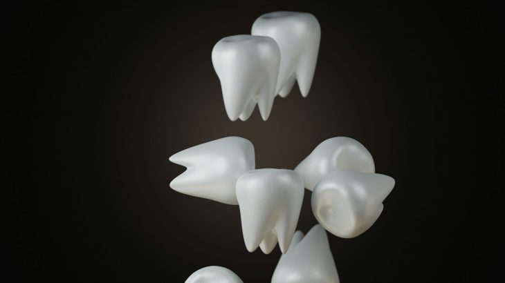 Dents
